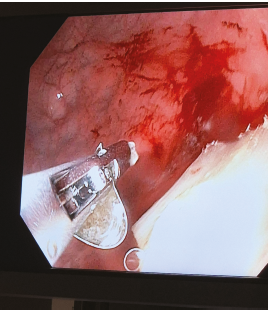 Endoskopické zákroky probíhaly na&nbsp;Pediatrické klinice 2. LF UK a&nbsp;FN Motol