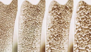 Ilustrační foto. Zdroj: iStock