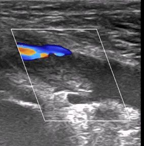 novak_obr-1b novak_obr-1b