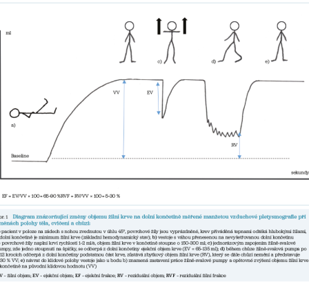 Obr. 1 Diagram znázorňující změny objemu žilní krve na&nbsp;dolní končetině