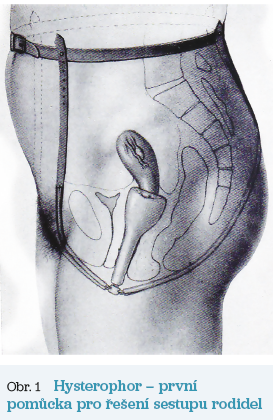 Obr. 1 Hysterophor