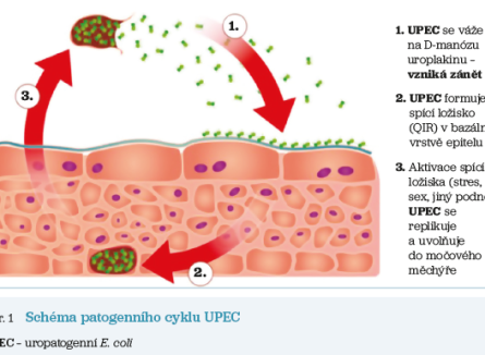 Obr. 1 Schéma patogenního cyklu UPEC