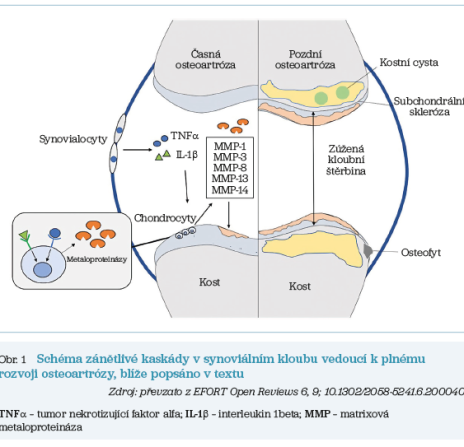 Obr. 1 Schéma zánětlivé kaskády v&nbsp;synoviálním kloubu
