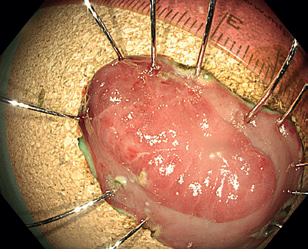 Obr. 14 Resekát našpendlený na&nbsp;korkovou podložku.