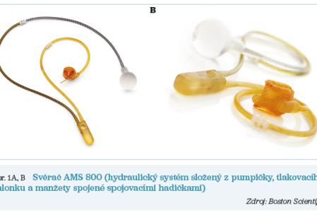 Obr. 1A, B&nbsp;Svěrač AMS 800
