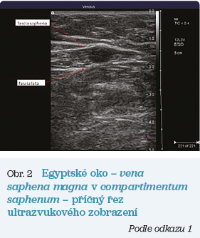 Obr. 2 Egyptské oko