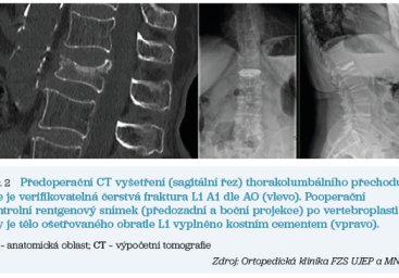 Obr. 2 Předoperační CT vyšetření