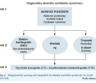 Obr. 3 Diagnostický postup při&nbsp;suspekci na&nbsp;akutní aortální syndrom
