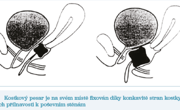Obr. 3 Kostkový pesar