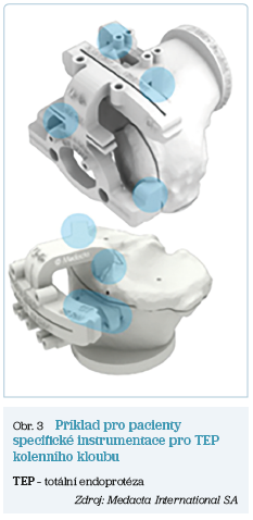 Obr. 3 Příklad pro&nbsp;pacienty specifické instrumentace pro&nbsp;TEP kolenního kloubu
