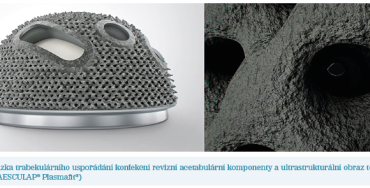 Obr. 7 Ukázka trabekulárního uspořádání konfekční revizní acetabulární komponenty a&nbsp;ultrastrukturální obraz