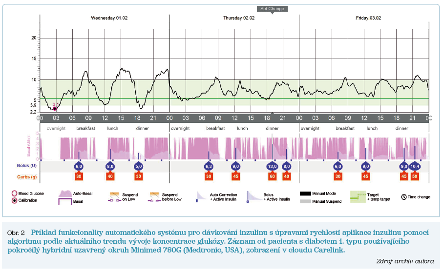 Obr. 2 Příklad funkcionality automatického systému pro dávkování inzulinu s úpravami rychlosti aplikace inzulinu pomocí algoritmu podle aktuálního trendu vývoje koncentrace glukózy. Záznam od pacienta s diabetem 1. typu používajícího pokročilý hybridní uzavřený okruh Minimed 780G (Medtronic, USA), zobrazení v cloudu Carelink. Zdroj: archiv autora 23-1_21