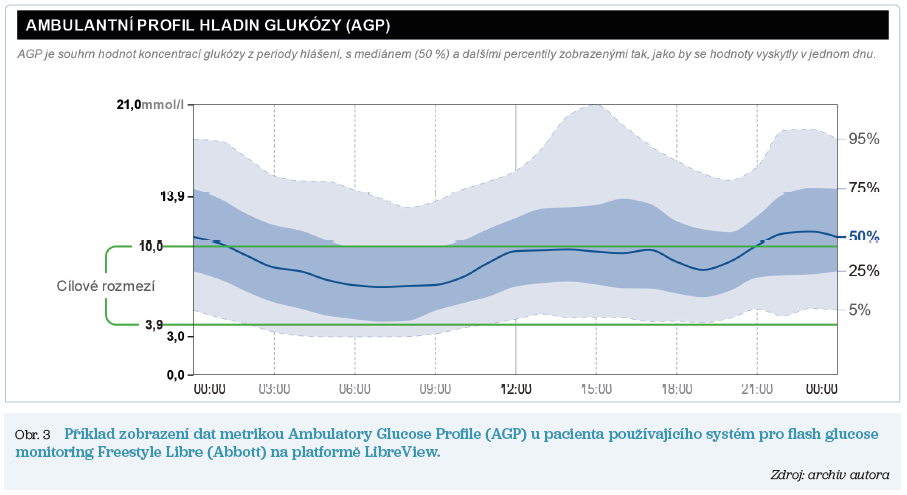 Obr. 3 Příklad zobrazení dat metrikou Ambulatory Glucose Profile (AGP) u pacienta používajícího systém pro flash glucose monitoring Freestyle Libre (Abbott) na platformě LibreView. Zdroj: archiv autora 23-1_22