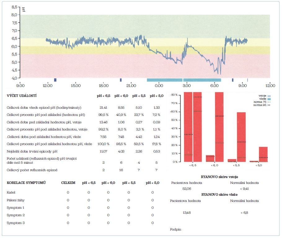 Obr. 4 Patologický záznam 24hodinové monitorace orofaryngeálního pH: Během 24hodinové monitorace jsme zaznamenali ve&nbsp;vzpřímené poloze po&nbsp;celou dobu měření slabě kyselé pH. V&nbsp;nočních hodinách v&nbsp;poloze vleže jsme zaznamenali výrazně kyselé refluxní epizody. Ryanovo skóre pro&nbsp;vzpřímenou polohu je 52,06 (norma < 9,4). Ryanovo skóre pro&nbsp;polohu vleže je 13,48 (norma < 6,8). Vyšetření prokazuje refluxní etiologii potíží pacienta (EERCH). EERCH – mimojícnová refluxní choroba jícnu (extraezofageální refluxní choroba)
