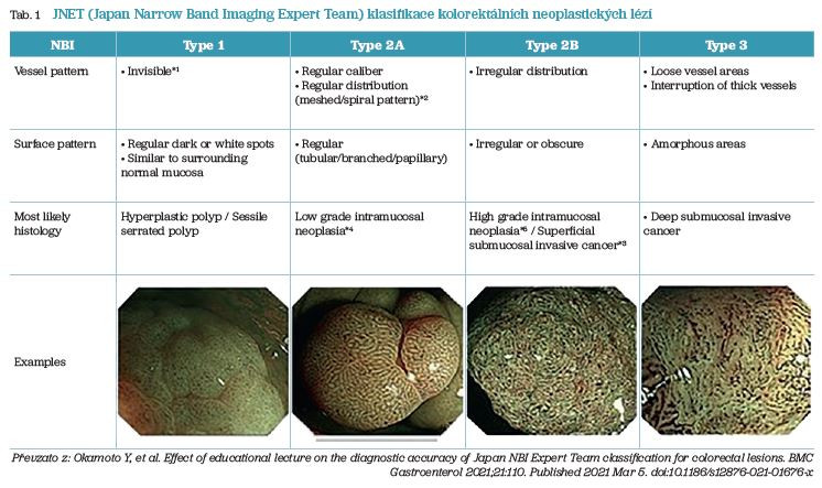 Tab. 1 JNET (Japan Narrow Band Imaging Expert Team) klasifikace kolorektálních neoplastických lézí