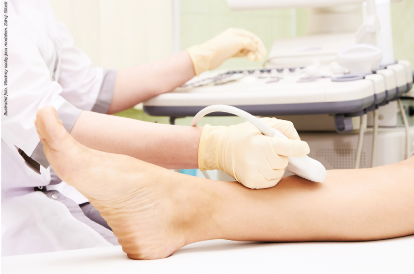 duplexní ultrasonografie