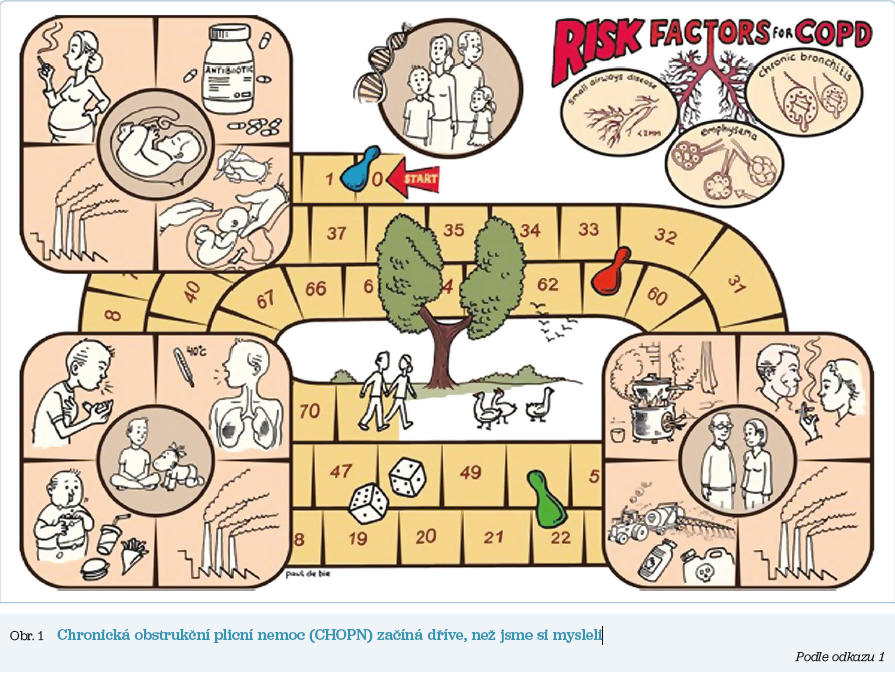 Obr. 1 Chronická obstrukční plicní nemoc (CHOPN) začíná dříve, než jsme si mysleli