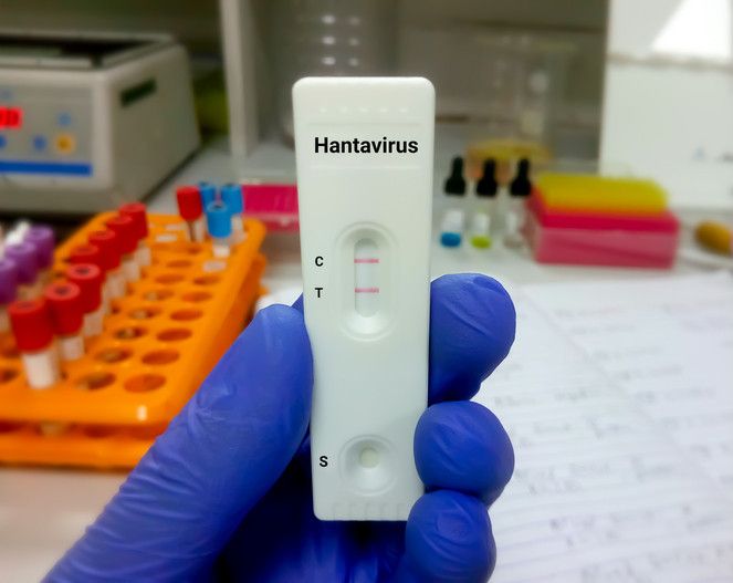hantavirus